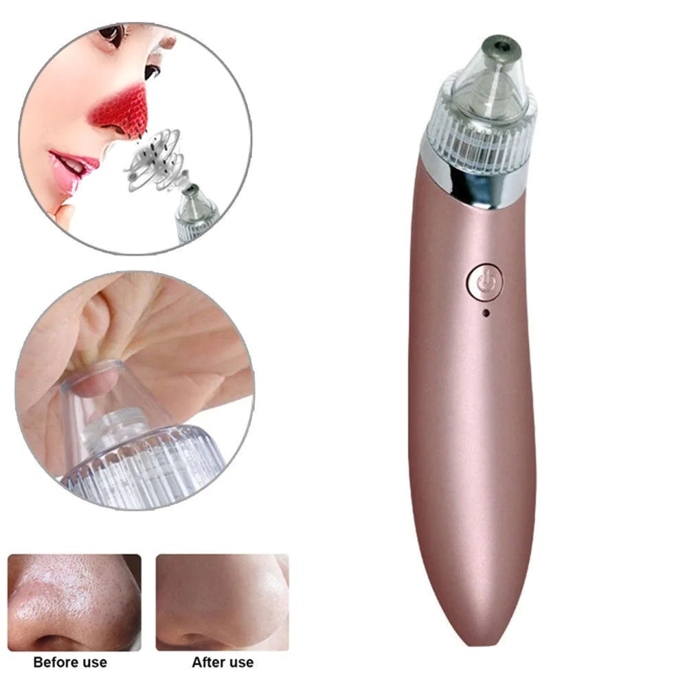 Electric Blackhead Remover Facial Pore Vacuum with 4 Heads