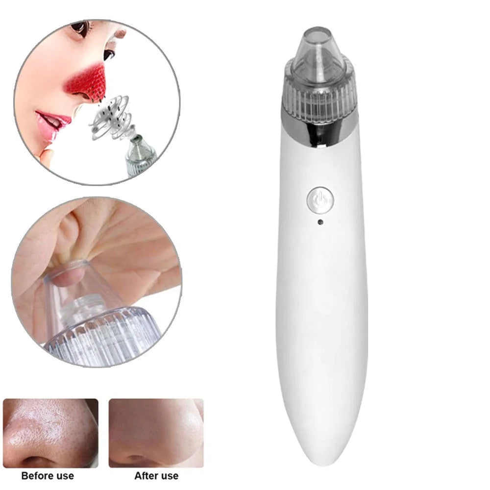 Electric Blackhead Remover Facial Pore Vacuum with 4 Heads