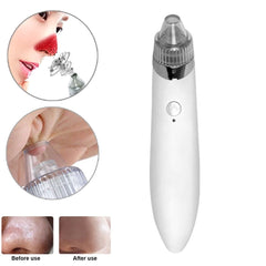 Electric Blackhead Remover Facial Pore Vacuum with 4 Heads